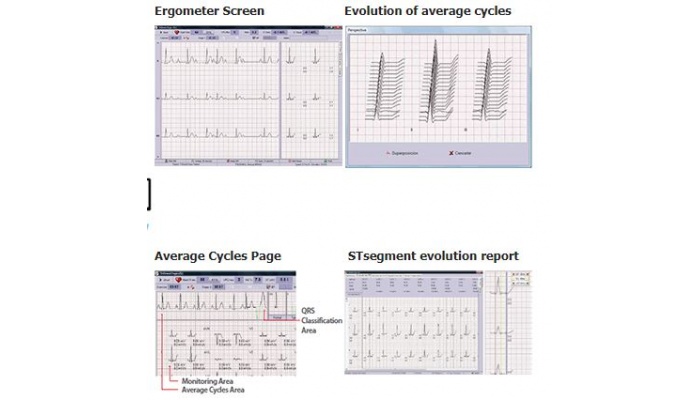 Stress ECG SW TRISMED Stress ECG S/W